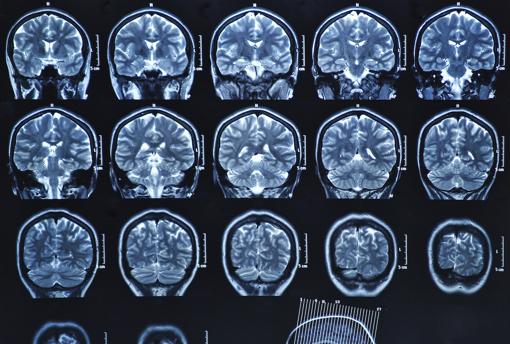 Scientist scanned his brain 2X a week for more than a year, and what he ...